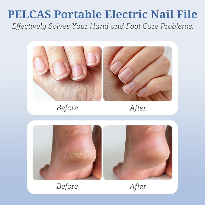 PELCAS Electric Nail File, Manicure and Pedicure Kit 5 Speeds & LED Light | Cordless Nail Drill, Toenail Grinder for Thick Toenails, Dremel Tool Kit for Human, Pet, Toenails, Natural & Acrylic Nails