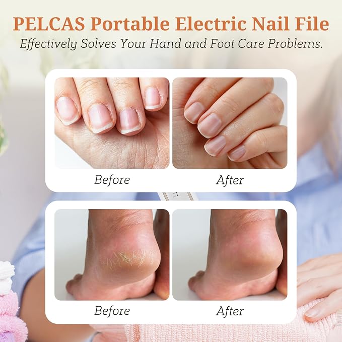 PELCAS Electric Toenail Grinder for Thick Toenails, 5 Speeds & LED Light | Manicure and Pedicure Kit, Cordless Nail Drill, Electric Nail File for Human, Pet, Thick Toenails, Natural & Acrylic Nails