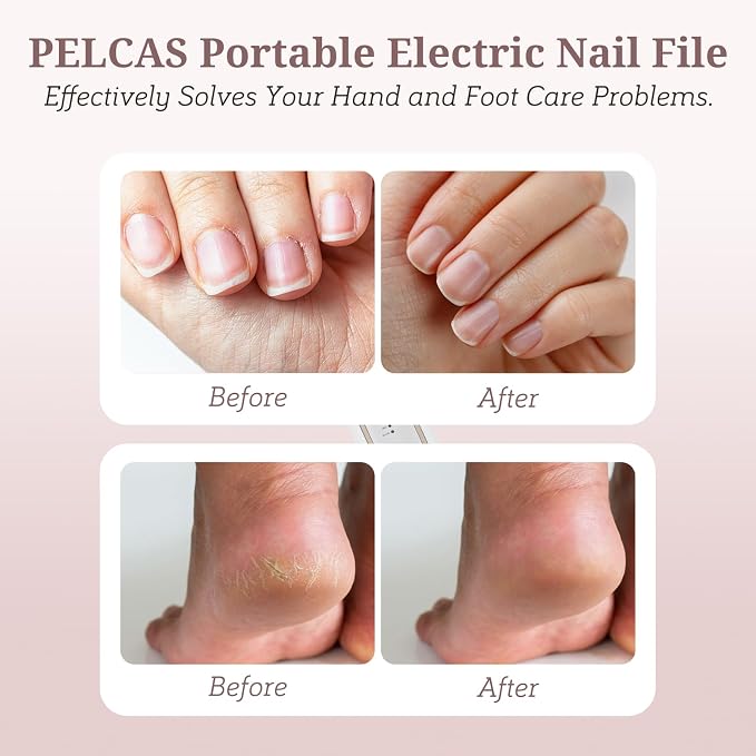 PELCAS Electric Nail File, 5 Speeds Nail Grinder for Thick Toenails | 5 Speeds Manicure and Pedicure Kit with LED Light, Electric Nail File for Human,Seniors,Thick Toenails,Natural, Acrylic Nails